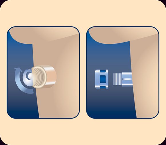 Airway illustrations